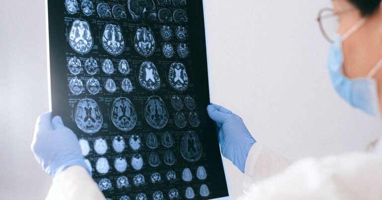 MRI brain scan of aneurysm patient